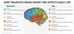How Does a Tbi Work