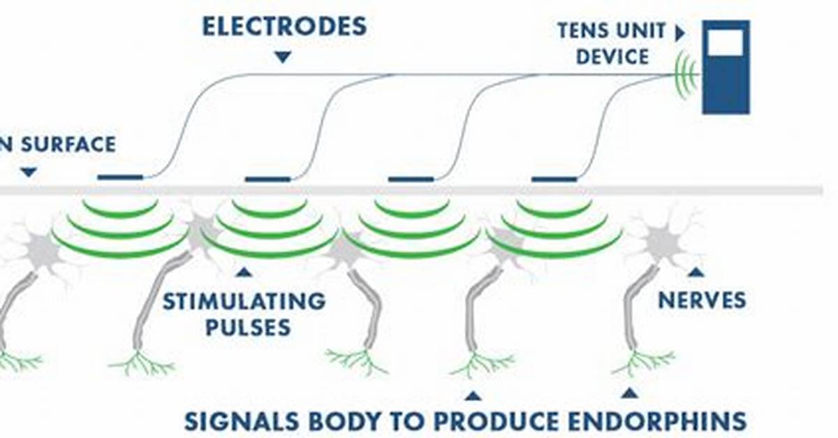 How Does a Tens Unit Work?