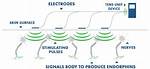 How Does a Tens Unit Work?