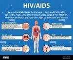 How Does Aids Work?