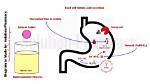 How Does Antacid Work?