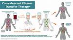 How Does Convalescent Plasma Work?
