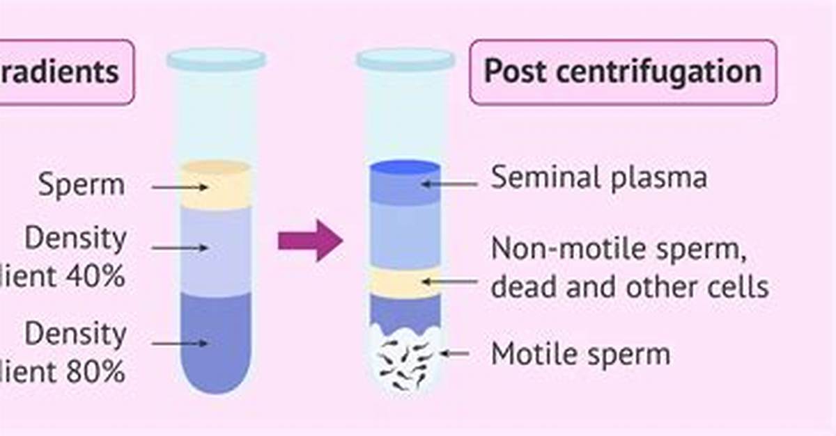 How Does Density Gradient Centrifugation Work?