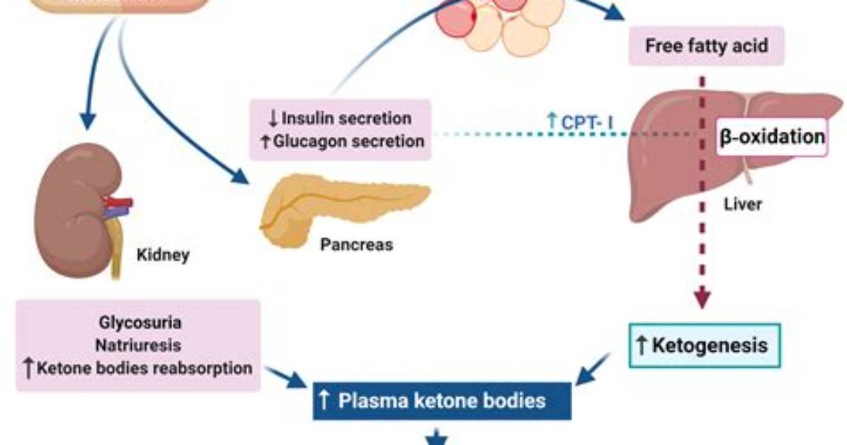 How Does Dka Euglycemic