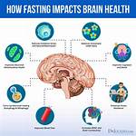 How Does Fasting Affect Your Brain?