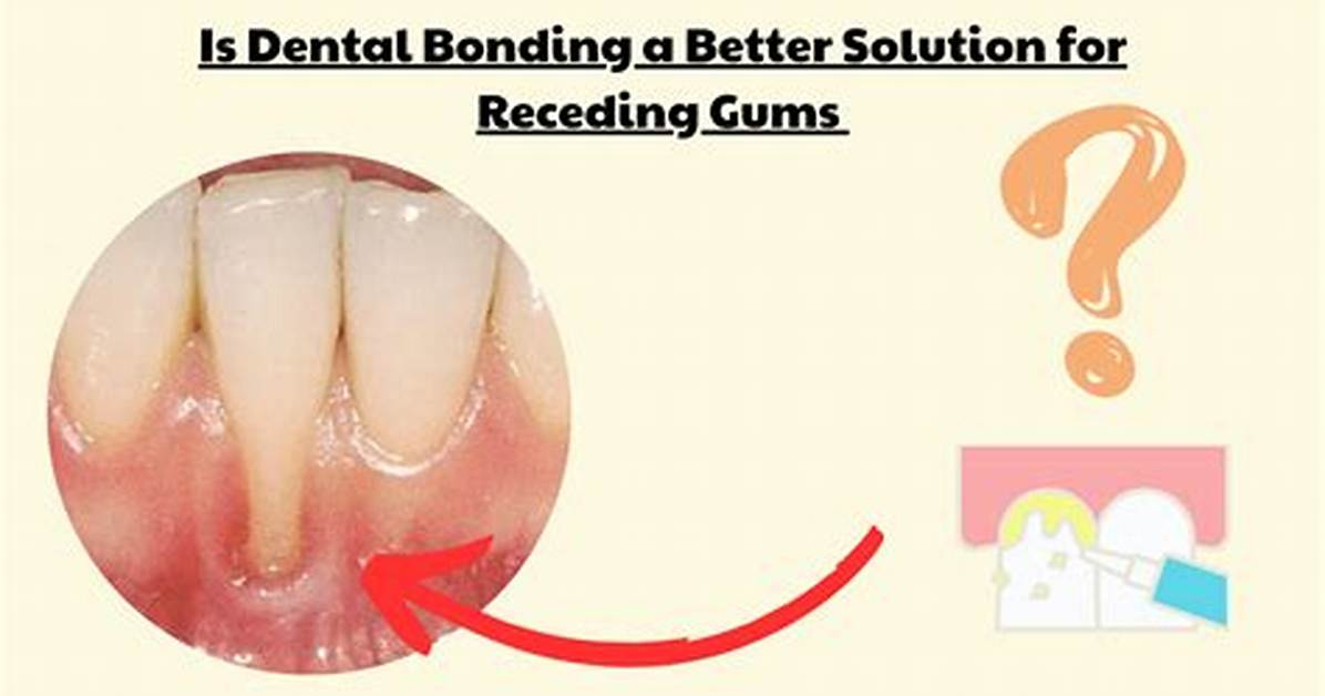 How Does Gum Bonding Work