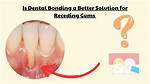 How Does Gum Bonding Work