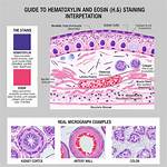 How Does H and E Stain Work