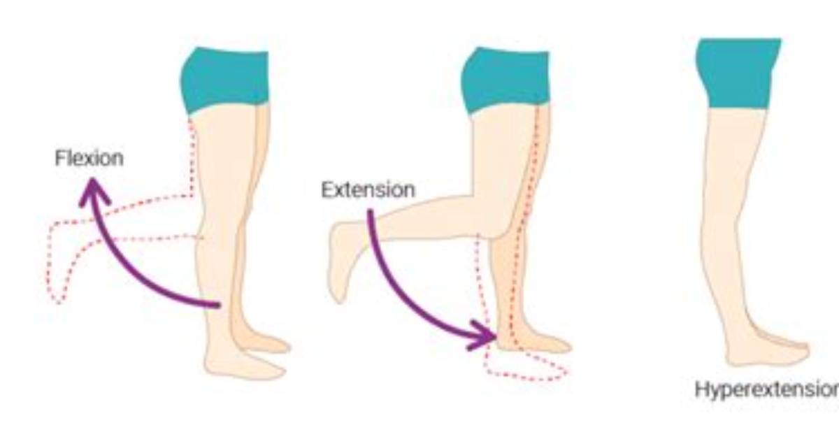 How Does Hyperflexion Occur?