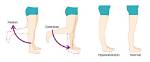 How Does Hyperflexion Occur?