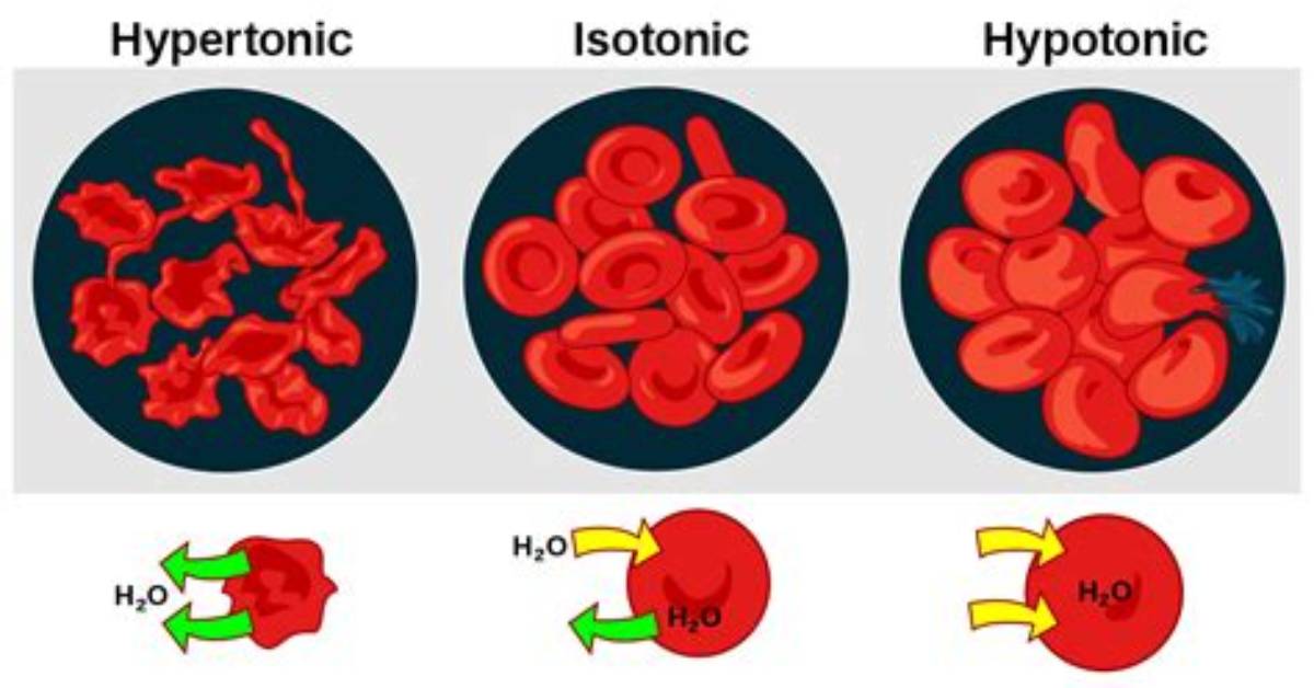 How Does Hypertonicity Happen?
