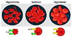How Does Hypertonicity Happen?