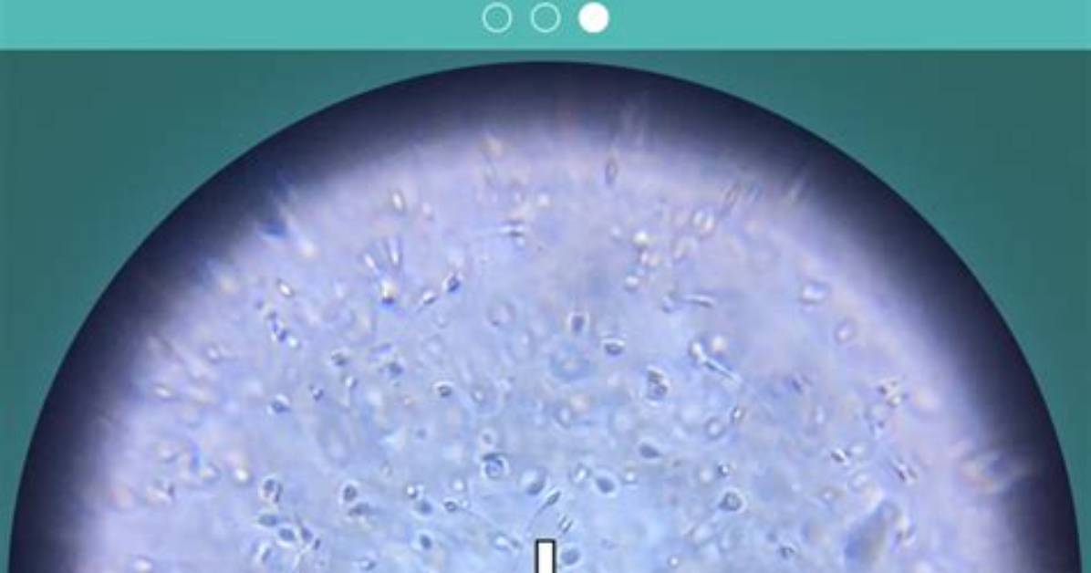 How Does Loupe App Work?