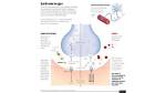 How Does Nerve Gas Kill