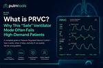 How Does Prvc Mode Work