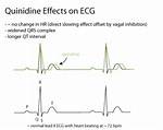 How Does Quinidine Effect Digoxin?