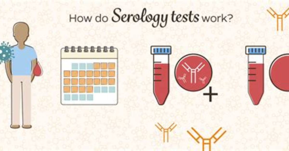 How Does Serological Test Work?