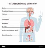 How Does Smoking Affect the Functioning of Bronchi?