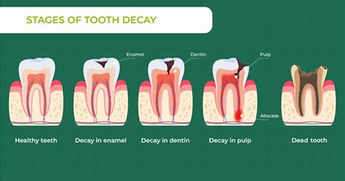How Does Sqqq Decay?