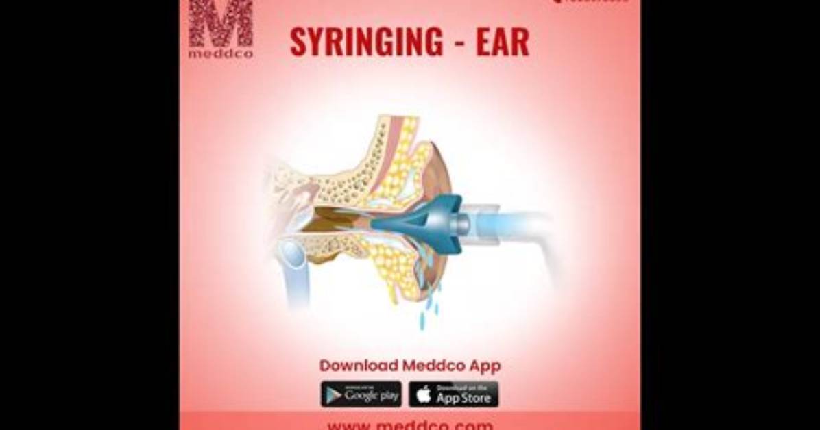How Does Syringing Ears Work?