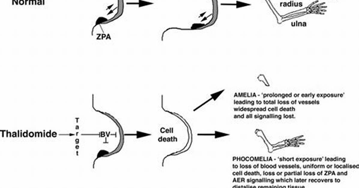 How Does Thalidomide Causes Phocomelia?