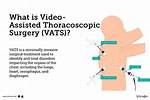How Does the Vats System Work?