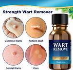 How Does Wart Remover Work?