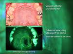 How Effective Is Velscope