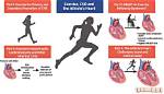 How Exercise Affects Heart Rate?