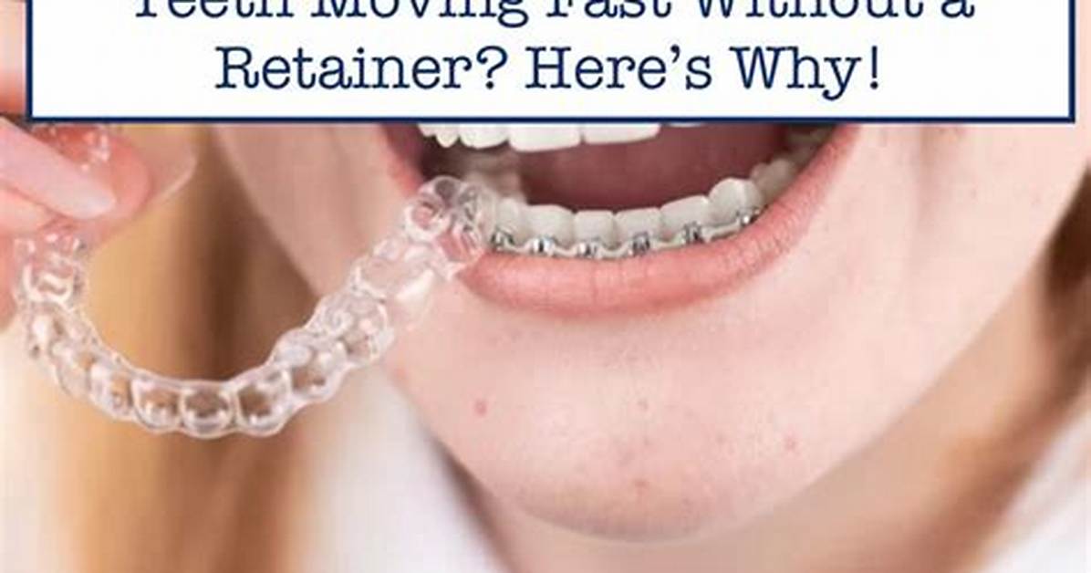 How Fast Do Teeth Move Without Retainer?