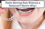 How Fast Do Teeth Move Without Retainer?