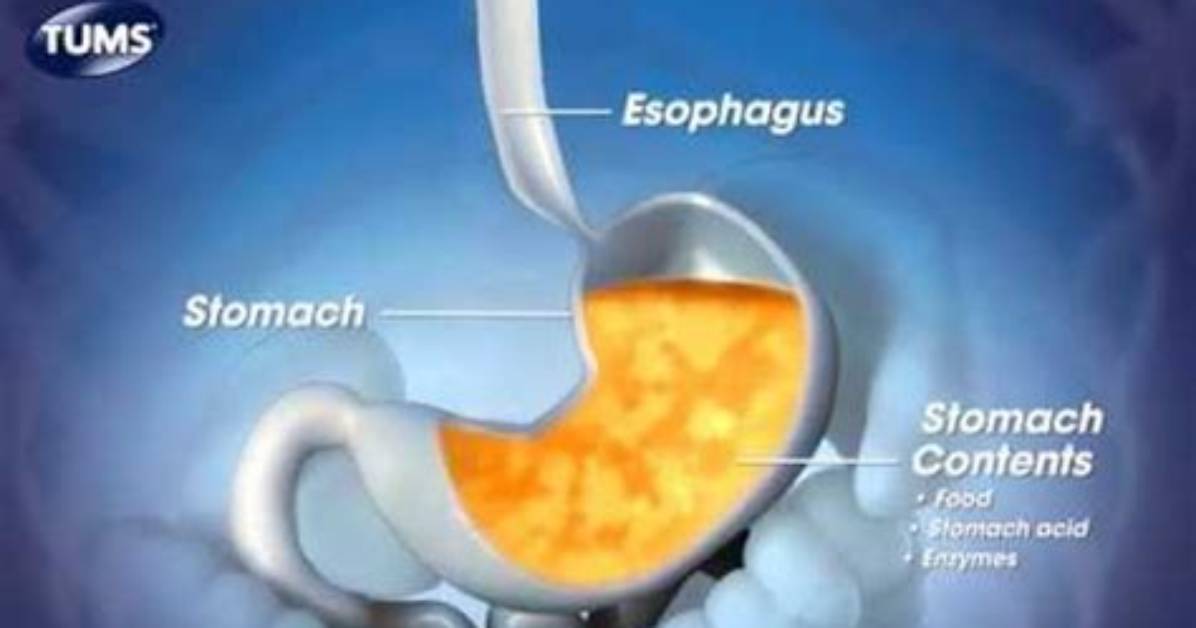 How Fast Do Tums Work