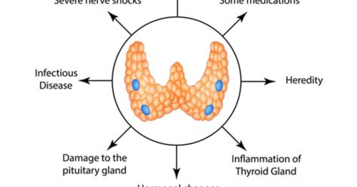 How Gtd Causes Hyperthyroidism?