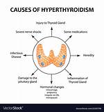How Gtd Causes Hyperthyroidism?