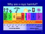 How Harmful Are X Rays?