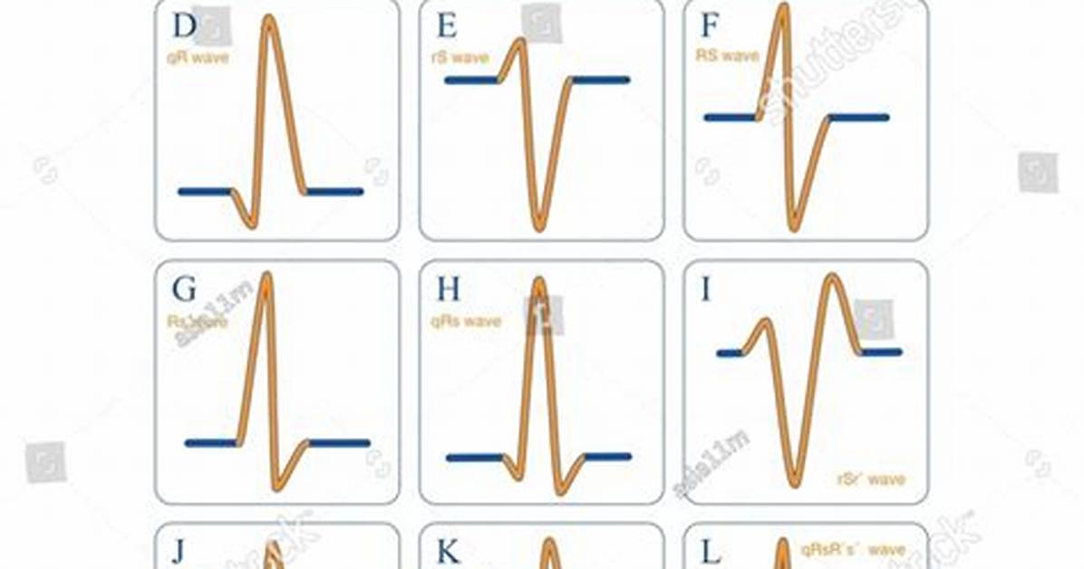 How Is Ecg Generated