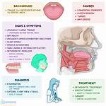 How Is Macroglossia Causes?