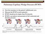 How Is Pcwp Calculated? | Contextresponse. Com