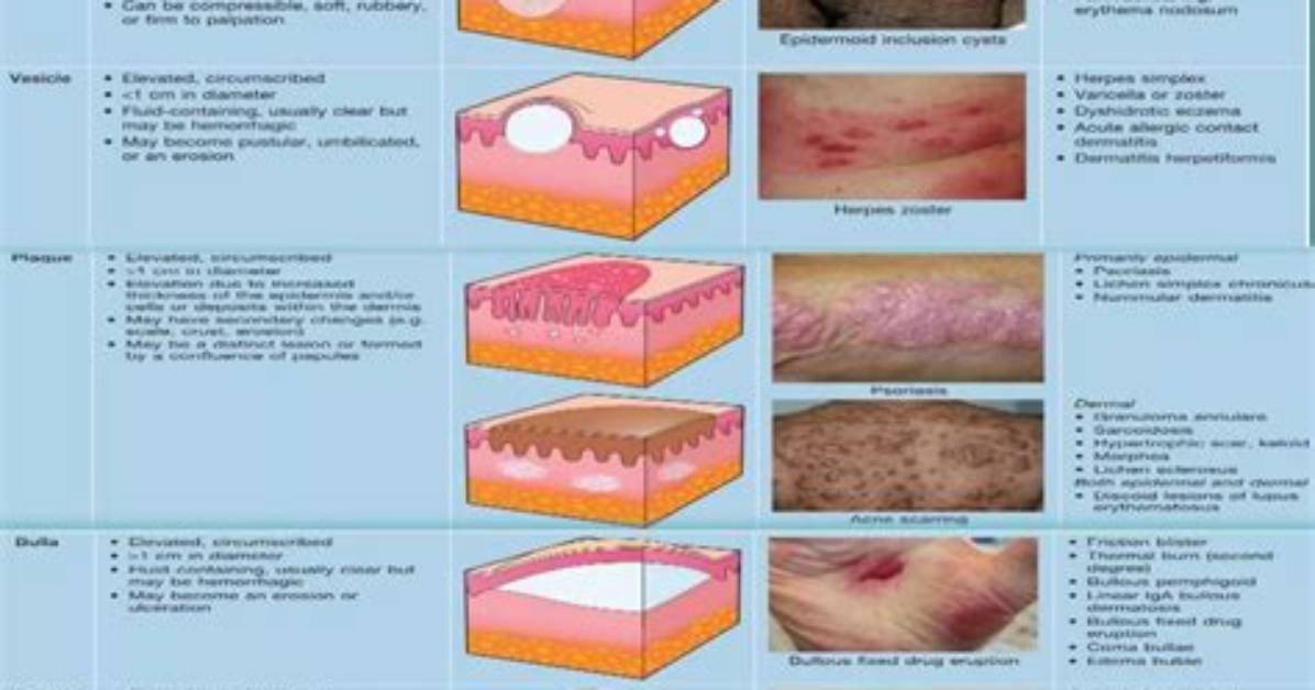 How Itching Is Caused?