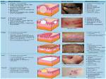 How Itching Is Caused?