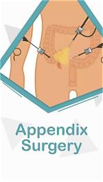 How Long Appendix Surgery?