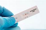 How Long Chlamydia Test Negative?