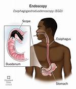 How Long Does an Endoscopy?