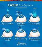 How Long Does Lasik Last?