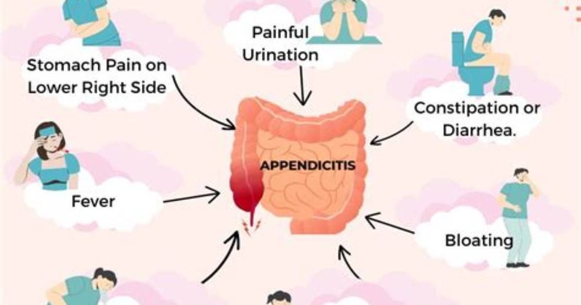 How Long Grumbling Appendix?