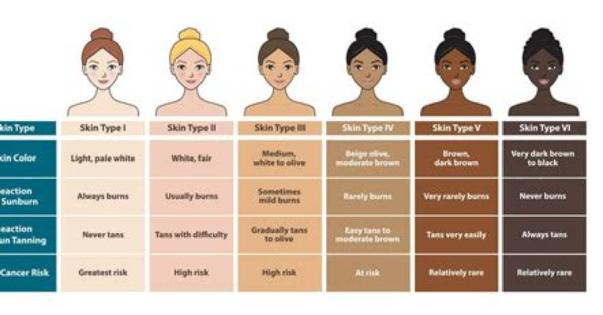 How Many Complexion Are There?
