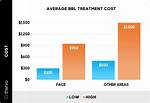 How Much Does a Bbl Cost?