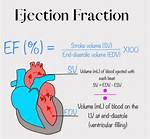 How Much Ejection Fraction Is Normal?