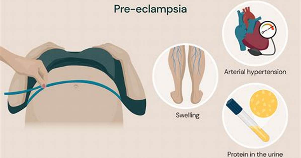 How Quickly Can Pre Eclampsia Develop?