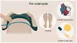 How Quickly Can Pre Eclampsia Develop?